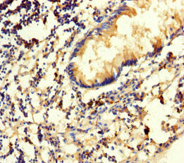 Immunohistochemistry of paraffin-embedded human appendix tissue using SRM Antibody at dilution of 1:100Rabbit anti-Human SRM Polyclonal Antibody