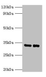 Western blot  | All lanes: SRM antibody at 2µg/ml  | Lane 1: EC109 whole cell lysate  | Lane 2: 293T whole cell lysate  | Secondary  | Goat polyclonal to rabbit IgG at 1/15000 dilution  | Predicted band size: 34 kDa  | Observed band size: 34 kDaRabbit anti-Human SRM Polyclonal Antibody