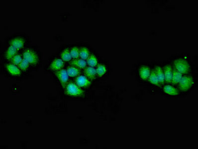 Immunofluorescent analysis of PC-3 cells using PRKAG1 Antibody at dilution of 1:100 and Alexa Fluor 488-congugated AffiniPure Goat Anti-Rabbit IgG(H+L)Rabbit anti-Human PRKAG1 Polyclonal Antibody