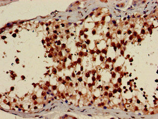 Immunohistochemistry of paraffin-embedded human testis tissue using PRKAG1 Antibody at dilution of 1:100Rabbit anti-Human PRKAG1 Polyclonal Antibody