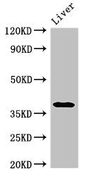 Western Blot | Positive WB detected in: Rat liver tissue | All lanes: PRKAG1 antibody at 3μg/ml | Secondary | Goat polyclonal to rabbit IgG at 1/50000 dilution | Predicted band size: 38, 35, 39 kDa | Observed band size: 38 kDaRabbit anti-Human PRKAG1 Polyclonal Antibody