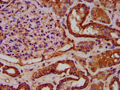 IHC image of ELP1 Antibody diluted at 1:600 and staining in paraffin-embedded human kidney tissue performed on a Leica BondTM system. After dewaxing and hydration, antigen retrieval was mediated by high pressure in a citrate buffer (pH 6.0). Section was blocked with 10% normal goat serum 30min at RT. Then primary antibody (1% BSA) was incubated at 4°C overnight. The primary is detected by a biotinylated secondary antibody and visualized using an HRP conjugated SP system.Rabbit anti-Human ELP1 Polyclonal Antibody