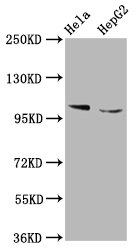 Western Blot | Positive WB detected in: Hela whole cell lysate, HepG2 whole cell lysate | All lanes: IKBKAP antibody at 5.3μg/ml | Secondary | Goat polyclonal to rabbit IgG at 1/50000 dilution | Predicted band size: 151 kDa | Observed band size: 151 kDaRabbit anti-Human ELP1 Polyclonal Antibody
