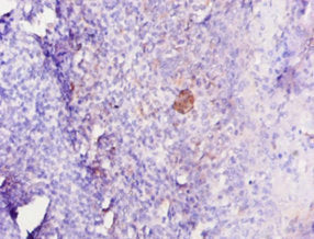 Immunohistochemistry of paraffin-embedded human tonsil tissue using IL12B Antibody at dilution of 1:10Rabbit anti-Ovis aries (Sheep) IL12B Polyclonal Antibody