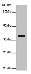 Western blot | All lanes: Interleukin-12 subunit beta antibody at 14μg/ml + K562 whole cell lysate | Secondary | Goat polyclonal to rabbit IgG at 1/10000 dilution | Predicted band size: 37 kDa | Observed band size: 37 kDaRabbit anti-Ovis aries (Sheep) IL12B Polyclonal Antibody