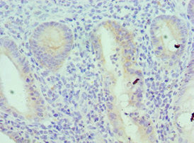Immunohistochemistry of paraffin-embedded human epityphlon tissue using IL18RAP Antibody at dilution of 1:100