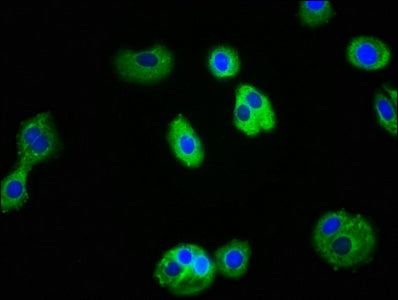 Immunofluorescence staining of HepG2 cells with IL1R1 Antibody at 1:100, counter-stained with DAPI. The cells were fixed in 4% formaldehyde, permeabilized using 0.2% Triton X-100 and blocked in 10% normal Goat Serum. The cells were then incubated with the antibody overnight at 4°C. The secondary antibody was Alexa Fluor 488-congugated AffiniPure Goat Anti-Rabbit IgG(H+L).Rabbit anti-Human IL1R1 Polyclonal Antibody