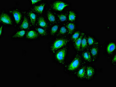 Immunofluorescent analysis of A549 cells using the antibody at dilution of 1: 100 and Alexa Fluor 488-congugated AffiniPure Goat Anti-Rabbit IgG(H+L)Rabbit anti-Human IL1R1 Polyclonal Antibody