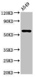 Western Blot | Positive WB detected in: A549 whole cell lysate | All lanes: IL1R1 antibody at 3μg/ml | Secondary | Goat polyclonal to rabbit IgG at 1/50000 dilution | Predicted band size: 66 kDa | Observed band size: 66 kDaRabbit anti-Human IL1R1 Polyclonal Antibody
