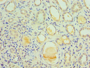 Immunohistochemistry of paraffin-embedded human kidney tissue using IL1R1 Antibody at dilution of 1:100