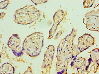 Immunohistochemistry of paraffin-embedded human placenta tissue using IL1R1 Antibody at dilution of 1:100