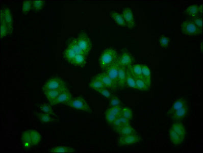 Immunofluorescence staining of HepG2 cells with IL1RAPL1 Antibody at 1:133, counter-stained with DAPI. The cells were fixed in 4% formaldehyde, permeabilized using 0.2% Triton X-100 and blocked in 10% normal Goat Serum. The cells were then incubated with the antibody overnight at 4°C. The secondary antibody was Alexa Fluor 488-congugated AffiniPure Goat Anti-Rabbit IgG(H+L).