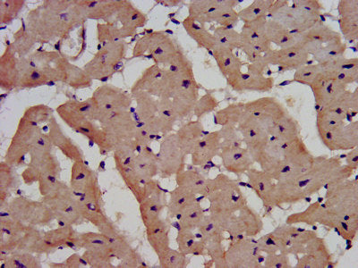 IHC image of IL1RAPL1 Antibody diluted at 1:400 and staining in paraffin-embedded human heart tissue performed on a Leica BondTM system. After dewaxing and hydration, antigen retrieval was mediated by high pressure in a citrate buffer (pH 6.0). Section was blocked with 10% normal goat serum 30min at RT. Then primary antibody (1% BSA) was incubated at 4°C overnight. The primary is detected by a biotinylated secondary antibody and visualized using an HRP conjugated SP system.