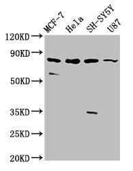 Western Blot  | Positive WB detected in: MCF-7 whole cell lysate, Hela whole cell lysate, SH-SY5Y whole cell lysate, U87 whole cell lysate  | All lanes: IL1RAPL1 antibody at 5.4µg/ml  | Secondary  | Goat polyclonal to rabbit IgG at 1/50000 dilution  | Predicted band size: 80 kDa  | Observed band size: 80 kDa