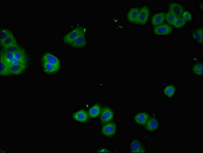 Immunofluorescent analysis of HepG2 cells using IL2RA Antibody at dilution of 1:100 and Alexa Fluor 488-congugated AffiniPure Goat Anti-Rabbit IgG(H+L)Rabbit anti-Human IL2RA Polyclonal Antibody