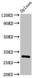 Western Blot | Positive WB detected in: Rat spleen tissue | All lanes: IL2RA antibody at 3.2μg/ml | Secondary | Goat polyclonal to rabbit IgG at 1/50000 dilution | Predicted band size: 31 kDa | Observed band size: 31 kDaRabbit anti-Human IL2RA Polyclonal Antibody