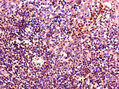 Immunohistochemistry of paraffin-embedded human tonsil tissue using IL4 Antibody at dilution of 1:100Rabbit anti-Human IL4 Polyclonal Antibody