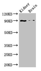 Western Blot | Positive WB detected in: Mouse kidney tissue, Mouse brain tissue | All lanes: IL4 antibody at 3μg/ml | Secondary | Goat polyclonal to rabbit IgG at 1/50000 dilution | Predicted band size: 18, 16 kDa | Observed band size: 90 kDaRabbit anti-Human IL4 Polyclonal Antibody