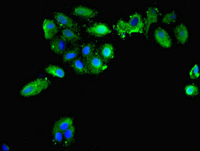 Immunofluorescent analysis of HepG2 cells using PRDX1 Antibody at dilution of 1:100 and Alexa Fluor 488-congugated AffiniPure Goat Anti-Rabbit IgG(H+L)Rabbit anti-Human PRDX1 Polyclonal Antibody