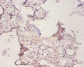 Immunohistochemistry of paraffin-embedded human placenta tissue using PRDX1 Antibody at dilution of 1:50Rabbit anti-Human PRDX1 Polyclonal Antibody