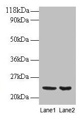 Western blot  | All lanes: PRDX1 antibody at 2µg/ml  | Lane 1: EC109 whole cell lysate  | Lane 2: 293T whole cell lysate  | Secondary  | Goat polyclonal to rabbit IgG at 1/15000 dilution  | Predicted band size: 23 kDa  | Observed band size: 23 kDaRabbit anti-Human PRDX1 Polyclonal Antibody