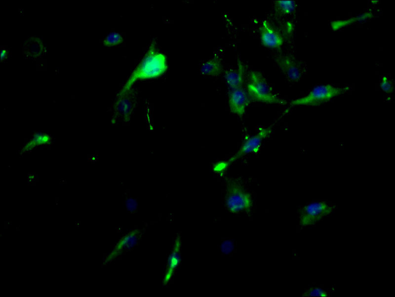 Immunofluorescence staining of U87 cells with IL7R Antibody at 1:200, counter-stained with DAPI. The cells were fixed in 4% formaldehyde, permeabilized using 0.2% Triton X-100 and blocked in 10% normal Goat Serum. The cells were then incubated with the antibody overnight at 4°C. The secondary antibody was Alexa Fluor 488-congugated AffiniPure Goat Anti-Rabbit IgG(H+L).Rabbit anti-Human IL7R Polyclonal Antibody