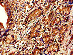 Immunohistochemistry of paraffin-embedded human small intestine tissue using the antibody at dilution of 1:100Rabbit anti-Human IL7R Polyclonal Antibody