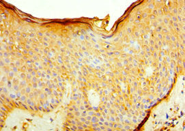 Immunohistochemistry of paraffin-embedded human skin tissue using IL7R Antibody at dilution of 1:100Rabbit anti-Human IL7R Polyclonal Antibody