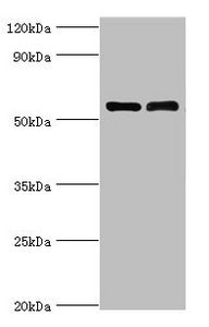 Western blot  | All lanes: IL7R antibody at 4µg/ml  | Lane 1: K562 whole cell lysate  | Lane 2: Jurkat whole cell lysate  | Secondary  | Goat polyclonal to rabbit IgG at 1/10000 dilution  | Predicted band size: 52, 35, 30, 29 kDa  | Observed band size: 52 kDaRabbit anti-Human IL7R Polyclonal Antibody