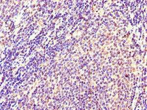 Immunohistochemistry of paraffin-embedded human lymph node tissue using the antibody at dilution of 1:100Rabbit anti-Human CXCR2 Polyclonal Antibody