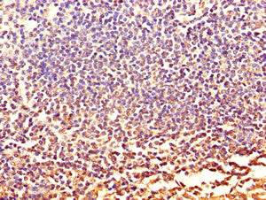 Immunohistochemistry of paraffin-embedded human tonsil tissue using CXCR2 Antibody at dilution of 1:100Rabbit anti-Human CXCR2 Polyclonal Antibody