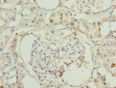Immunohistochemistry of paraffin-embedded human kidney tissue using ILVBL Antibody at dilution of 1:100Rabbit anti-Human ILVBL Polyclonal Antibody