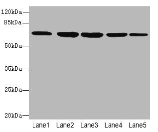 Western blot  | All lanes: ILVBL antibody at 4µg/ml  | Lane 1: HepG2 whole cell lysate  | Lane 2: Hela whole cell lysate  | Lane 3: A549 whole cell lysate  | Lane 4: Jurkat whole cell lysate  | Lane 5: U87 whole cell lysate  | Secondary  | Goat polyclonal to rabbit IgG at 1/10000 dilution  | Predicted band size: 68 kDa  | Observed band size: 68 kDaRabbit anti-Human ILVBL Polyclonal Antibody