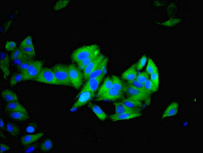Immunofluorescent analysis of Hela cells using IMPDH2 Antibody at dilution of 1:100 and Alexa Fluor 488-congugated AffiniPure Goat Anti-Rabbit IgG(H+L)Rabbit anti-Human IMPDH2 Polyclonal Antibody