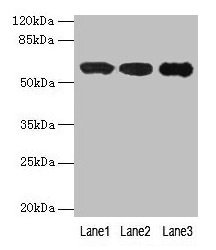 Western blot  | All lanes: IMPDH2 antibody at 12µg/ml  | Lane 1: Mouse heart tissue  | Lane 2: A549 whole cell lysate  | Lane 3: Hela whole cell lysate  | Secondary  | Goat polyclonal to rabbit IgG at 1/10000 dilution  | Predicted band size: 56 kDa  | Observed band size: 56 kDaRabbit anti-Human IMPDH2 Polyclonal Antibody