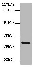 Western blot  | All lanes: INMT antibody at 2µg/ml + Mouse lung tissue  | Secondary  | Goat polyclonal to rabbit lgG at 1/15000 dilution  | Predicted band size: 29 kDa  | Observed band size: 29 kDa