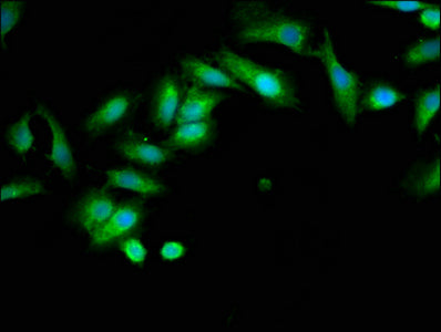 Immunofluorescence staining of Hela cells with INPP5B Antibody at 1:133, counter-stained with DAPI. The cells were fixed in 4% formaldehyde, permeabilized using 0.2% Triton X-100 and blocked in 10% normal Goat Serum. The cells were then incubated with the antibody overnight at 4°C. The secondary antibody was Alexa Fluor 488-congugated AffiniPure Goat Anti-Rabbit IgG(H+L).