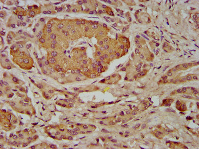 IHC image of INPP5B Antibody diluted at 1:400 and staining in paraffin-embedded human pancreatic tissue performed on a Leica BondTM system. After dewaxing and hydration, antigen retrieval was mediated by high pressure in a citrate buffer (pH 6.0). Section was blocked with 10% normal goat serum 30min at RT. Then primary antibody (1% BSA) was incubated at 4°C overnight. The primary is detected by a biotinylated secondary antibody and visualized using an HRP conjugated SP system.
