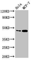 Western Blot  | Positive WB detected in: Hela whole cell lysate, MCF-7 whole cell lysate  | All lanes: INSIG1 antibody at 2.8µg/ml  | Secondary  | Goat polyclonal to rabbit IgG at 1/50000 dilution  | Predicted band size: 30, 18 kDa  | Observed band size: 46 kDa