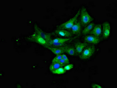 Immunofluorescent analysis of HepG2 cells using INSR Antibody at dilution of 1:100 and Alexa Fluor 488-congugated AffiniPure Goat Anti-Rabbit IgG(H+L)