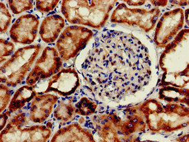 Immunohistochemistry of paraffin-embedded human kidney tissue using INSR Antibody at dilution of 1:100