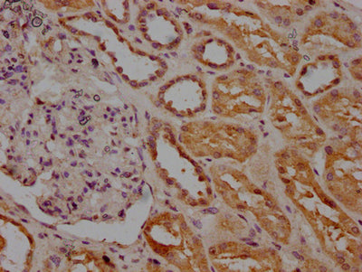 IHC image of INSRR Antibody diluted at 1:200 and staining in paraffin-embedded human kidney tissue performed on a Leica BondTM system. After dewaxing and hydration, antigen retrieval was mediated by high pressure in a citrate buffer (pH 6.0). Section was blocked with 10% normal goat serum 30min at RT. Then primary antibody (1% BSA) was incubated at 4°C overnight. The primary is detected by a biotinylated secondary antibody and visualized using an HRP conjugated SP system.Rabbit anti-Human INSRR Polyclonal Antibody