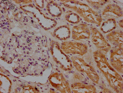 IHC image of INSRR Antibody diluted at 1:200 and staining in paraffin-embedded human kidney tissue performed on a Leica BondTM system. After dewaxing and hydration, antigen retrieval was mediated by high pressure in a citrate buffer (pH 6.0). Section was blocked with 10% normal goat serum 30min at RT. Then primary antibody (1% BSA) was incubated at 4°C overnight. The primary is detected by a biotinylated secondary antibody and visualized using an HRP conjugated SP system.Rabbit anti-Human INSRR Polyclonal Antibody