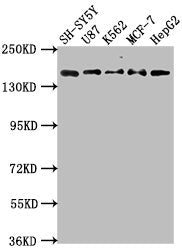 Western Blot | Positive WB detected in: SH-SY5Y whole cell lysate, U87 whole cell lysate, K562 whole cell lysate, MCF-7 whole cell lysatee, HepG2 whole cell lysate | All lanes: INSRR antibody at 1:2000 | Secondary | Goat polyclonal to rabbit IgG at 1/50000 dilution | Predicted band size: 144 kDa | Observed band size: 144 kDa