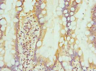 Immunohistochemistry of paraffin-embedded human small intestine tissue using INTS10 Antibody at dilution of 1:100