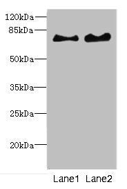 Western blot | All lanes: INTS10 antibody at 4.35μg/ml | Lane 1: Mouse kidney tissue | Lane 2: Rat gonadal tissue | Secondary | Goat polyclonal to rabbit IgG at 1/10000 dilution | Predicted band size: 82 kDa | Observed band size: 82 kDa