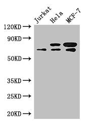Western Blot | Positive WB detected in: Jurkat whole cell lysate, Hela whole cell lysate, MCF-7 whole cell lysate | All lanes: INTS9 antibody at 3.4μg/ml | Secondary | Goat polyclonal to rabbit IgG at 1/50000 dilution | Predicted band size: 74, 72 kDa | Observed band size: 74, 72 kDa