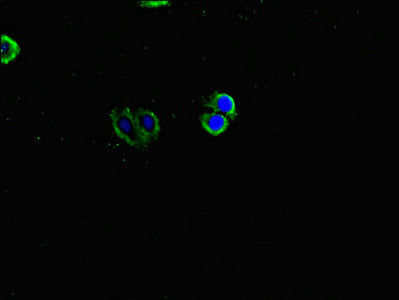 Immunofluorescent analysis of HepG2 cells using INVS Antibody at dilution of 1:100 and Alexa Fluor 488-congugated AffiniPure Goat Anti-Rabbit IgG(H+L)