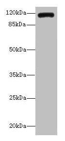 Western blot | All lanes: INVS antibody IgG at 14μg/ml + K562 whole cell lysate | Secondary | Goat polyclonal to rabbit IgG at 1/10000 dilution | Predicted band size: 118, 100, 11 kDa | Observed band size: 118 kDa