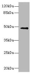 Western blot  | All lanes: IP6K2 antibody at 3.12µg/ml + Raji whole cell lysate  | Secondary  | Goat polyclonal to rabbit IgG at 1/10000 dilution  | Predicted band size: 50, 12, 9, 21, 22, 10 kDa  | Observed band size: 50 kDa